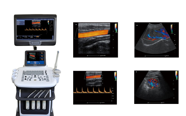多維彩超,四維彩超機(jī)